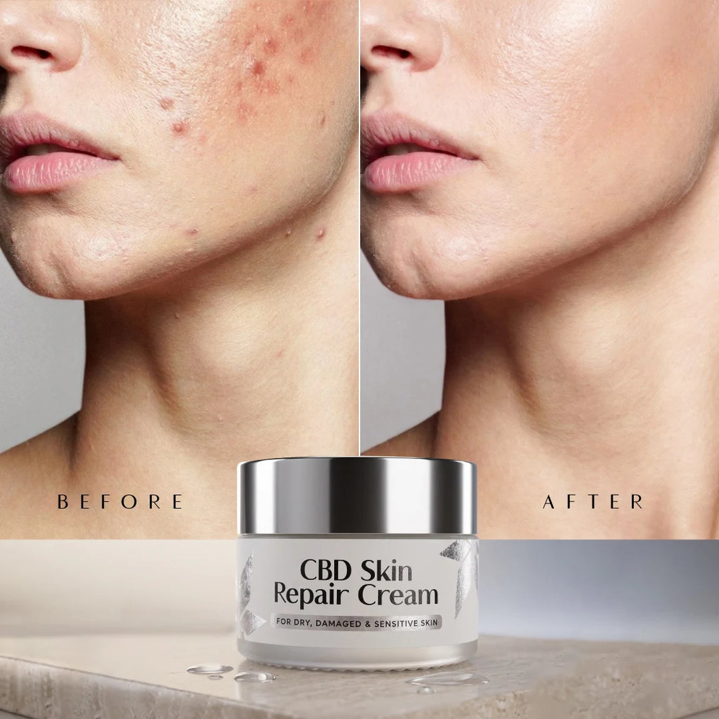 Before and after comparison of skin with CBD Skin Repair Cream application